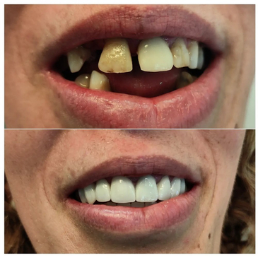 Slider image (3) Klinika Dentale ParaDent